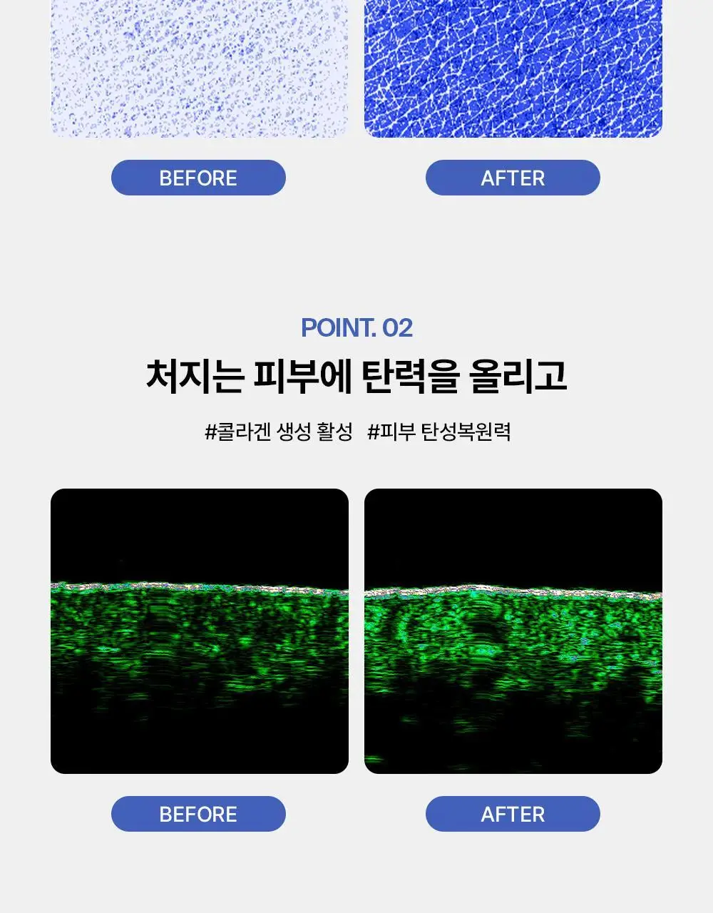 [탄력장벽] 퍼셀 픽셀바이옴 히알 콜라겐 유산균 크림 50ml 상세페이지 25